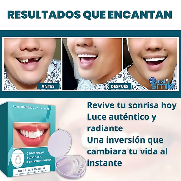 SmilePro - Carillas Dentales Ajustables De Resina 2x1