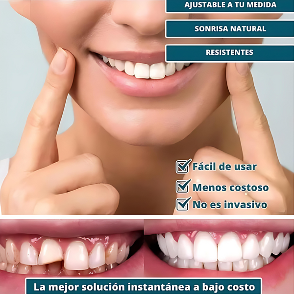 SmilePro - Carillas Dentales Ajustables De Resina 2x1