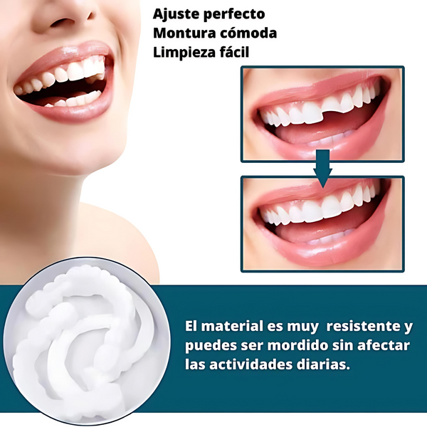 SmilePro - Carillas Dentales Ajustables De Resina 2x1
