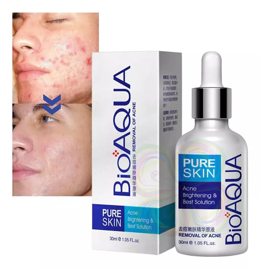 ✨ 2 Serum Pure Skin – ¡Adiós acné y espinillas! 🌿💧 2 kit